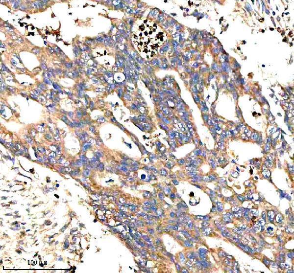 IHC analysis of STXBP3 using anti-STXBP3 antibody (A08994-2)