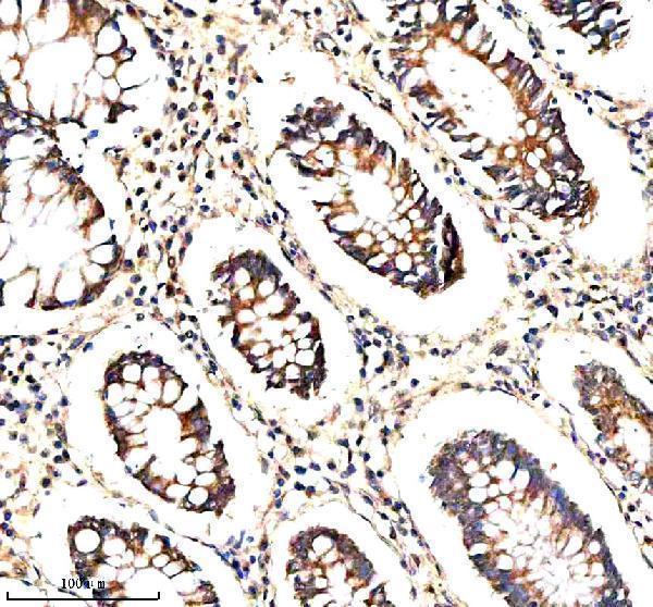 a08994 2 stxbp3 primary antibodies ihc testing 3