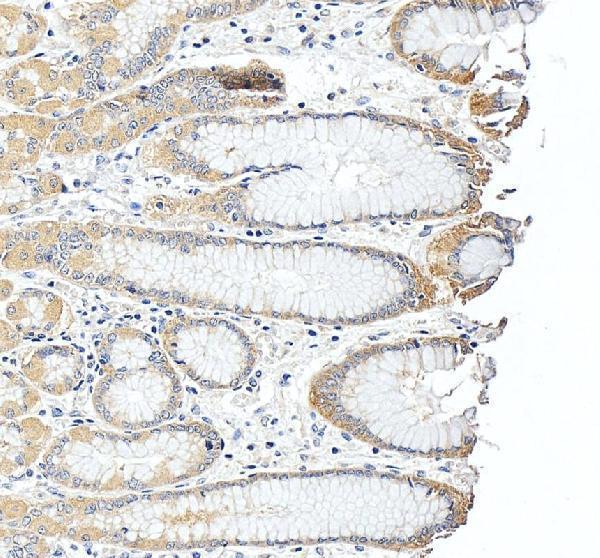 a08997 1 slc25a23 primary antibodies ihc testing 4