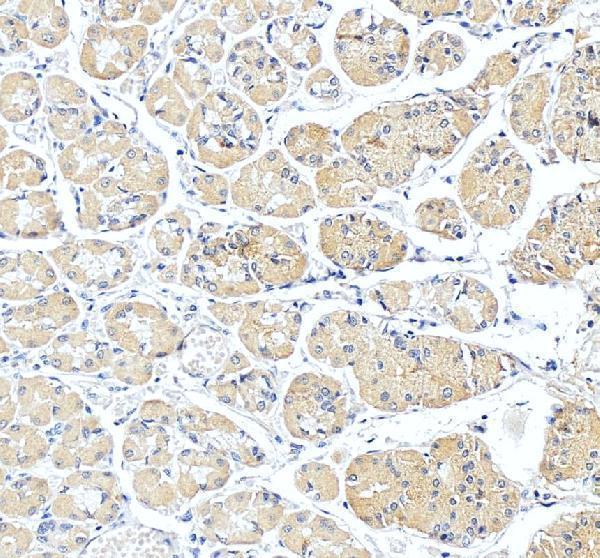 a08997 1 slc25a23 primary antibodies ihc testing 5