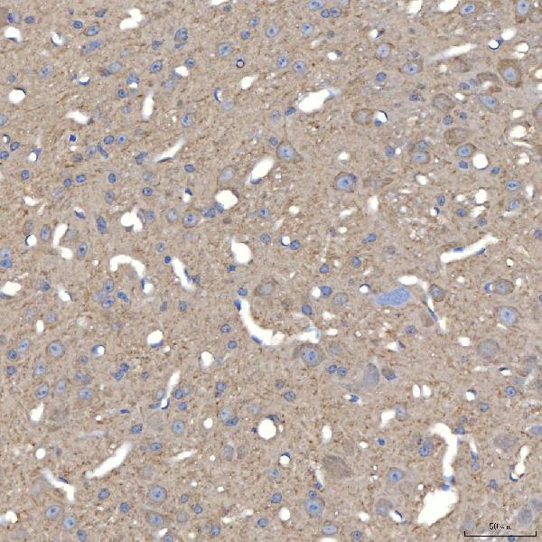 a08997 1 slc25a3 primary antibodies ihc testing 2