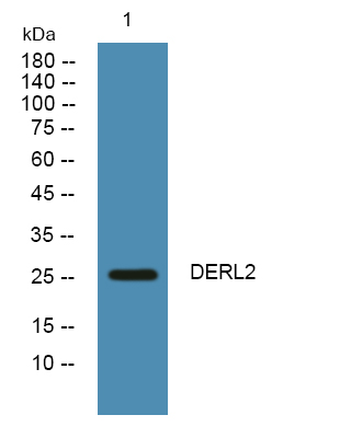 Western blot analysis of lysates from K562 cells, primary antibody was diluted at 1:1000, 4°over night
