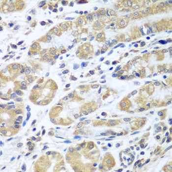 Immunohistochemistry of paraffin-embedded human stomach using EIF1AX antibody at dilution of 1:100 (40x lens)