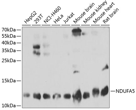 Western blot analysis of extracts of various cell lines, using NDUFA5 antibody  at 1:1000 dilution