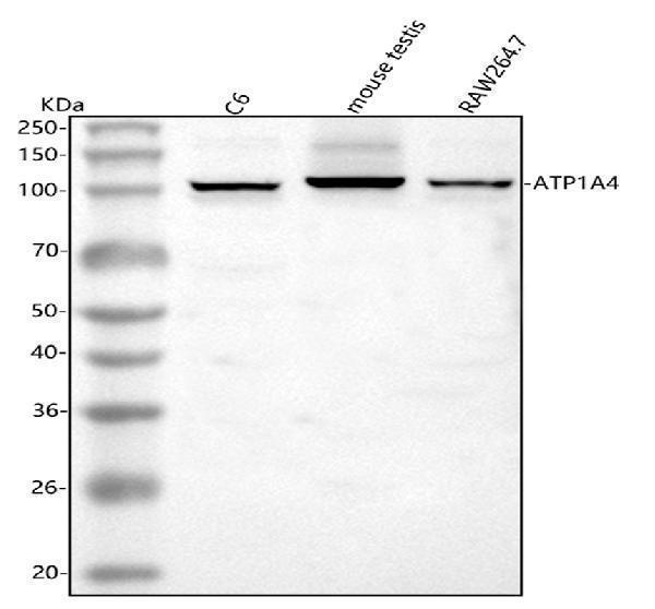  Western blot analysis of ATP1A4 using anti-ATP1A4 antibody (A09005)
