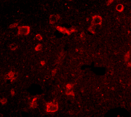 a09006 slitrk6 primary antibodies if testing 3