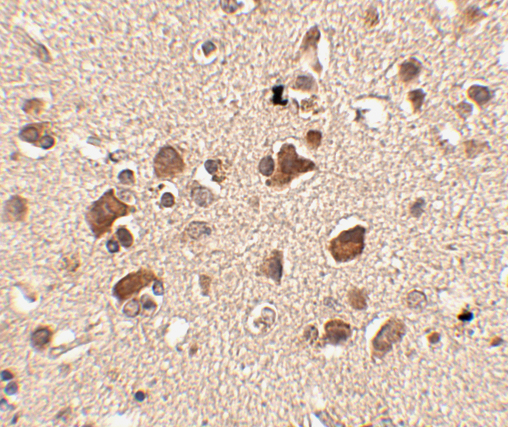 a09006 slitrk6 primary antibodies ihc testing 2