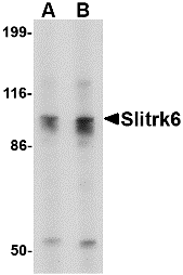 a09006 slitrk6 primary antibodies wb testing 1