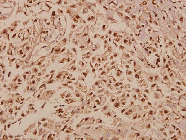 a09007 1 gtf2a1 primary antiboties ihc testing 2