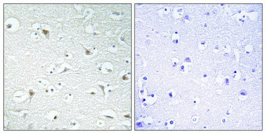 a09007 gtf2a1 primary antibodies ihc testing 1