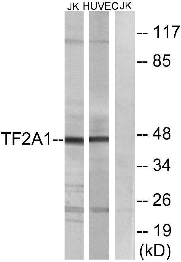a09007 gtf2a1 primary antibodies wb testing 2
