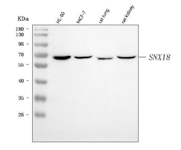  Western blot analysis of SNX18 using anti-SNX18 antibody (A09010-2)