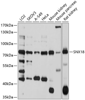 a09010 snx18 primary antiboties wb testing 1