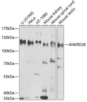 Western blot analysis of extracts of various cell lines, using ANKRD28 antibody  at 1:1000 dilution