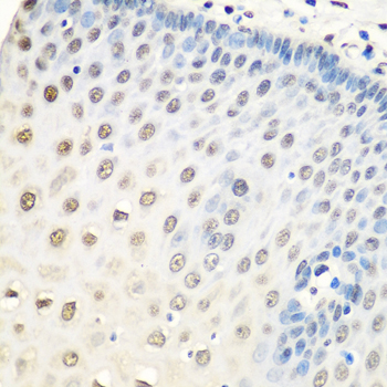 Immunoprecipitation analysis of 200ug extracts of 293T cells, using 3 ug HNRNPA0 antibody 