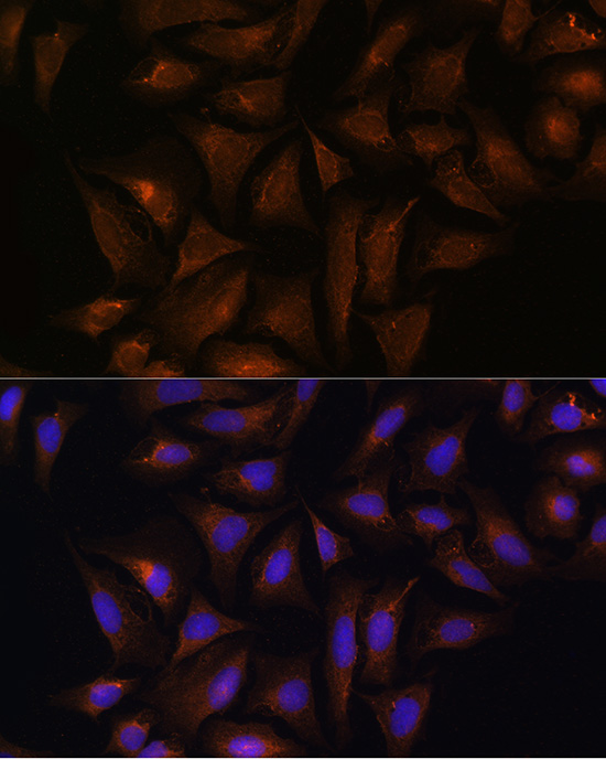 Immunofluorescence analysis of U-2 OS cells using CRYZ Rabbit pAb  at dilution of 1:100 