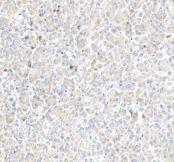 IHC analysis of CHAC1 using anti-CHAC1 antibody (A09017-2)