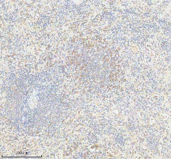 IHC analysis of DOK3 using anti-DOK3 antibody (A09019-2)