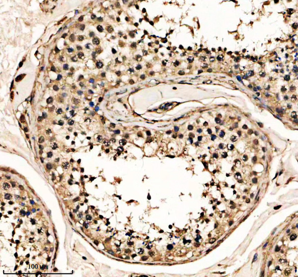 IHC analysis of ISY1 using anti-ISY1 antibody (A09020-1)