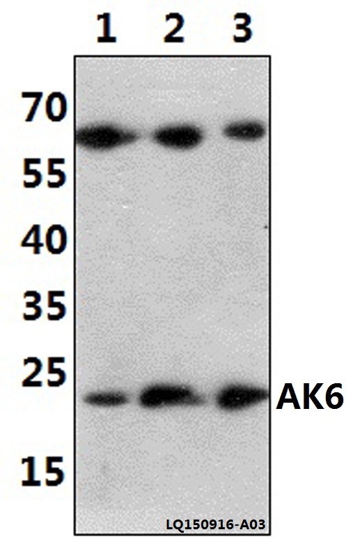 Western blot (WB) analysis of AK6 (G35) polyclonal antibody at 1:1000 dilution
Lane1:A549 whole cell lysate(40ug)
Lane2:The Lung tissue lysate of Rat(30ug)
Lane3:The Lung tissue lysate of Mouse(30ug)