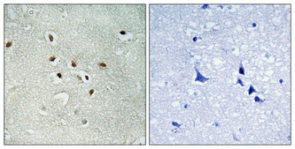 Immunohistochemical analysis of paraffin-embedded Human brain