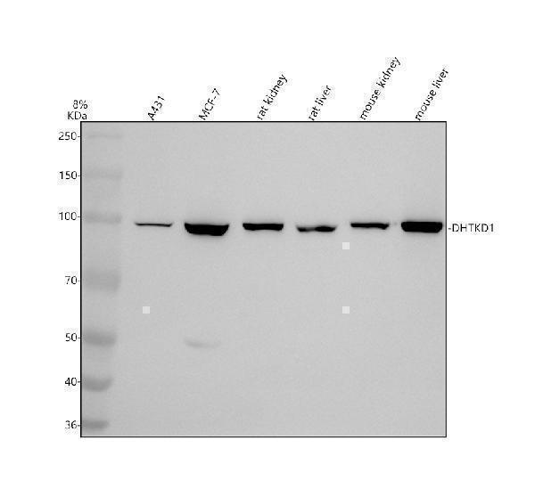Western blot analysis of DHTKD1 using anti-DHTKD1 antibody (A09027-1)