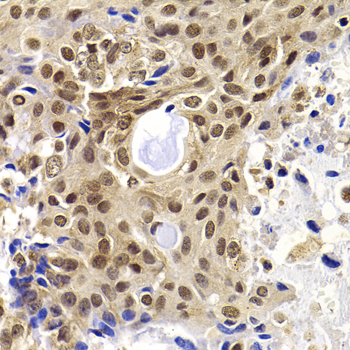 a09028 phf19 primary antiboties if testing 2