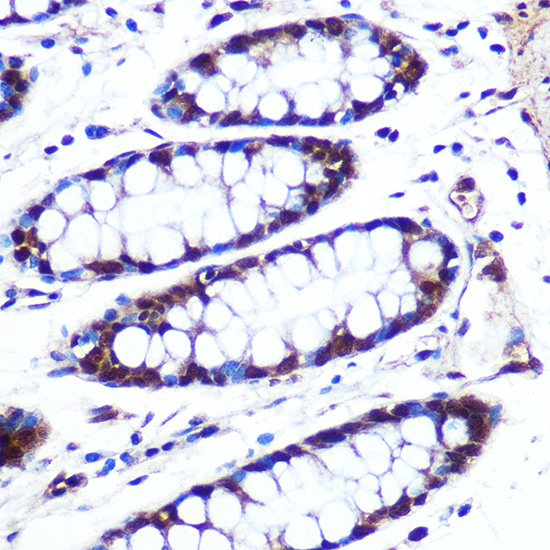 a09029 apip primary antiboties ihc testing 2