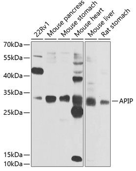 a09029 apip primary antiboties wb testing 1