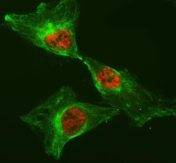 a09030 3 hnrnpll primary antibodies if testing 1