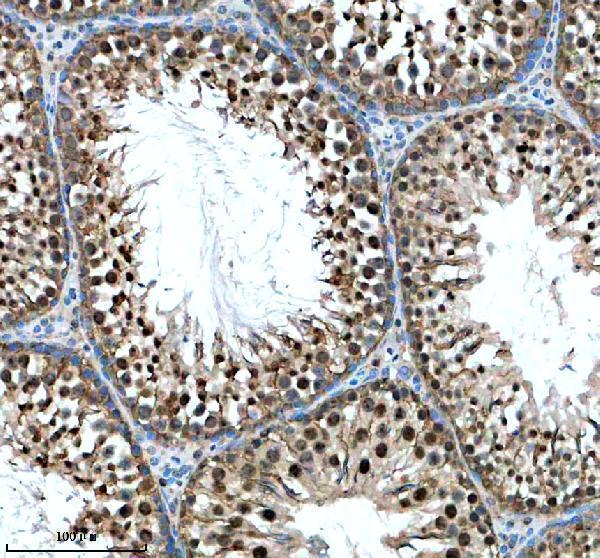a09030 3 hnrnpll primary antibodies ihc testing 2