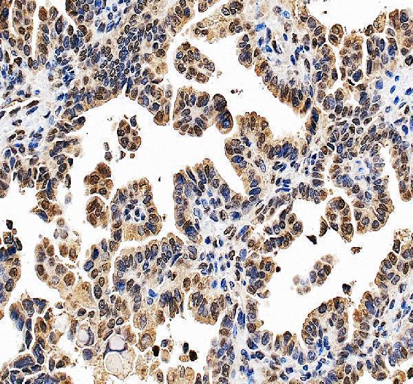 a09030 3 hnrnpll primary antibodies ihc testing 3