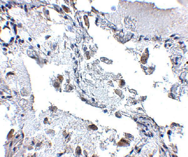 Immunohistochemistry of SH3BP4 in human lung tissue with SH3BP4 antibody at 5 μg/mL