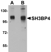 Western blot analysis of SH3BP4 in rat lung tissue lysate with SH3BP4 antibody at (A) 1 and (B) 2 μg/mL