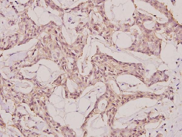 a09039 1 nemf primary antiboties ihc testing 2
