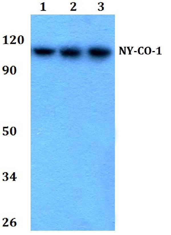 a09039 1 nemf primary antiboties wb testing 1