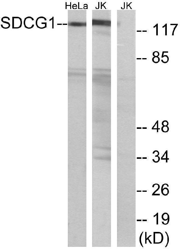 Western blot analysis of lysates from HeLa and Jurkat cells, using SDCG1 Antibody
