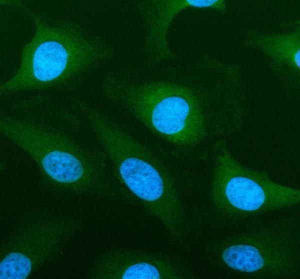 a09043 1 slc39a10 primary antibodies if testing 1