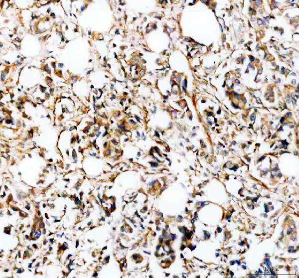 a09043 1 slc39a10 primary antibodies ihc testing 1