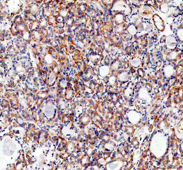 a09043 1 slc39a10 primary antibodies ihc testing 2