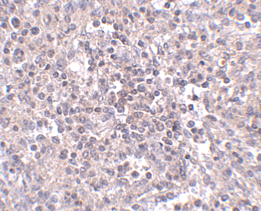 a09043 slc39a10 primary antibodies ihc testing 2