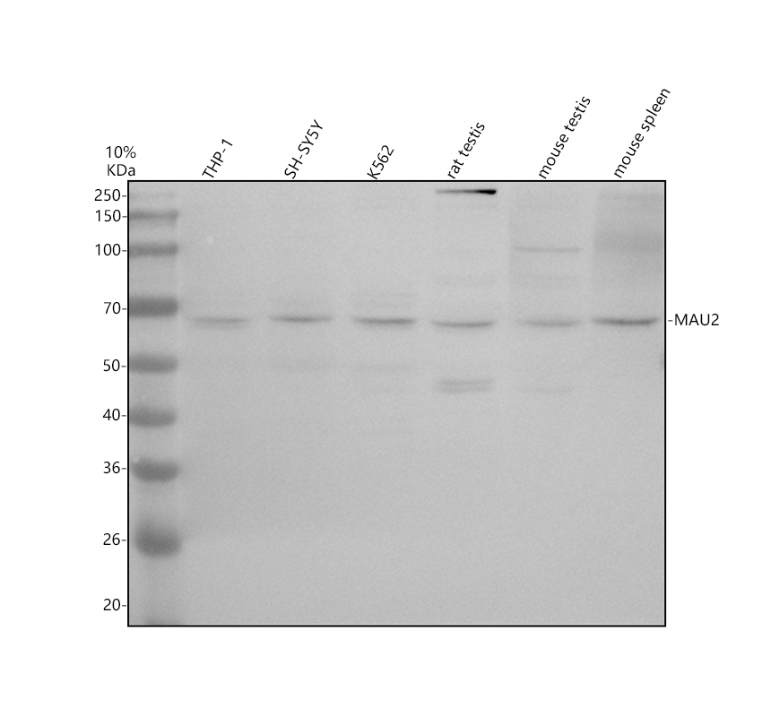 Western blot analysis of SCC4/MAU2 using anti-SCC4/MAU2 antibody (A09045-1)
