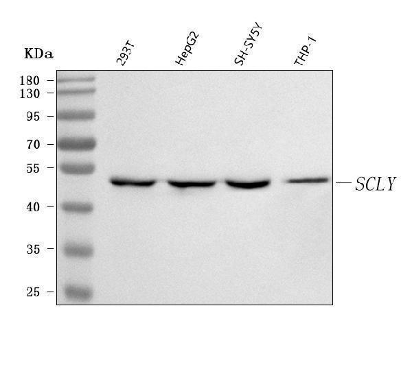  Western blot analysis of SCLY using anti-SCLY antibody (A09046)