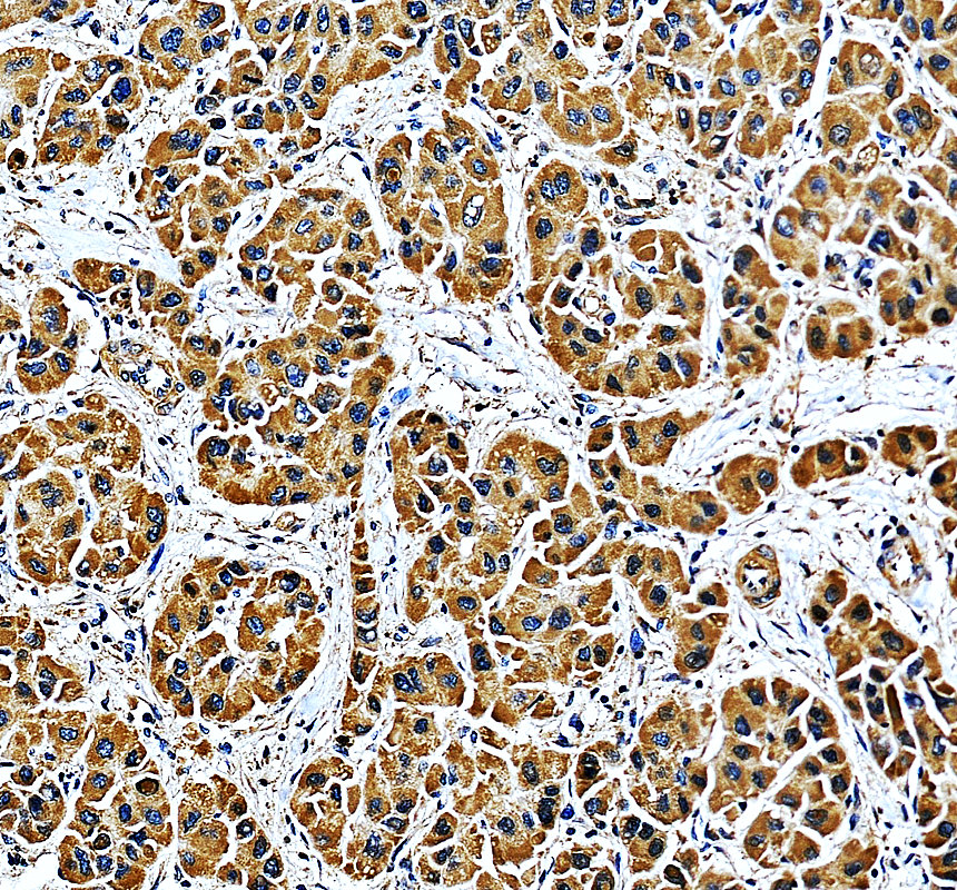 a09051 1 mtf2 primary antibodies ihc testing 1