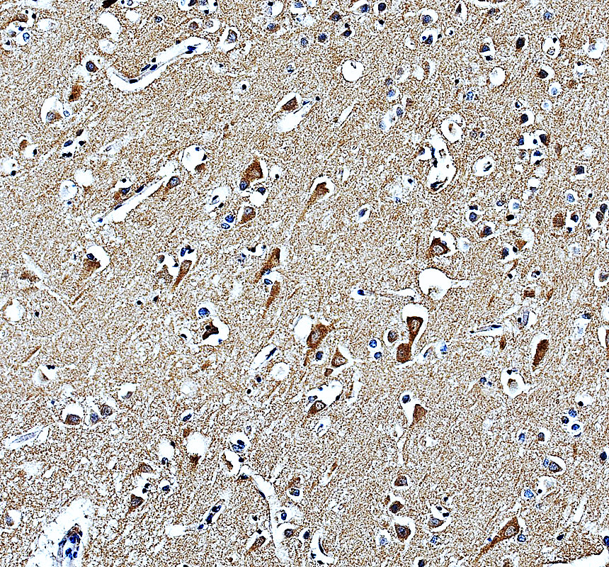 a09051 1 mtf2 primary antibodies ihc testing 2