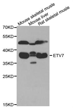 WesternBlot (WB) analysis of ETV7 polyclonal antibody