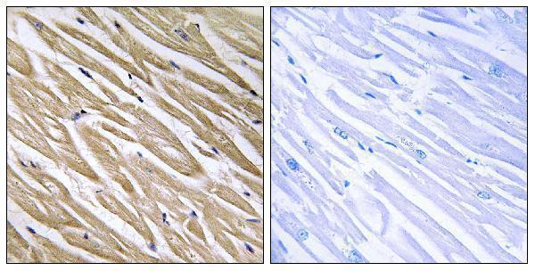 Immunohistochemistry analysis of paraffin-embedded human heart tissue, using C5orf13 Antibody