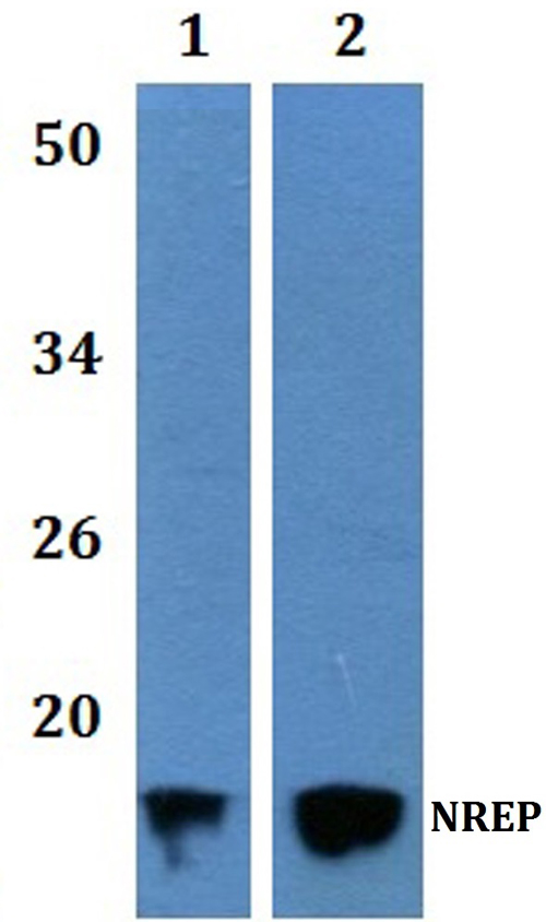 Western blot (WB) analysis of NREP polyclonal antibody at 1:500 dilution  Lane1:HEK293T whole cell lysate   Lane2:H9C2 whole cell lysate    
