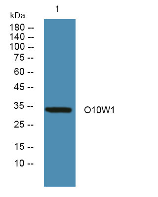 Western blot analysis of lysates from HCT116 cells, primary antibody was diluted at 1:1000, 4°over night