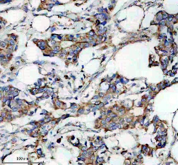 a09062 1 lrrc26 primary antibodies ihc testing 1